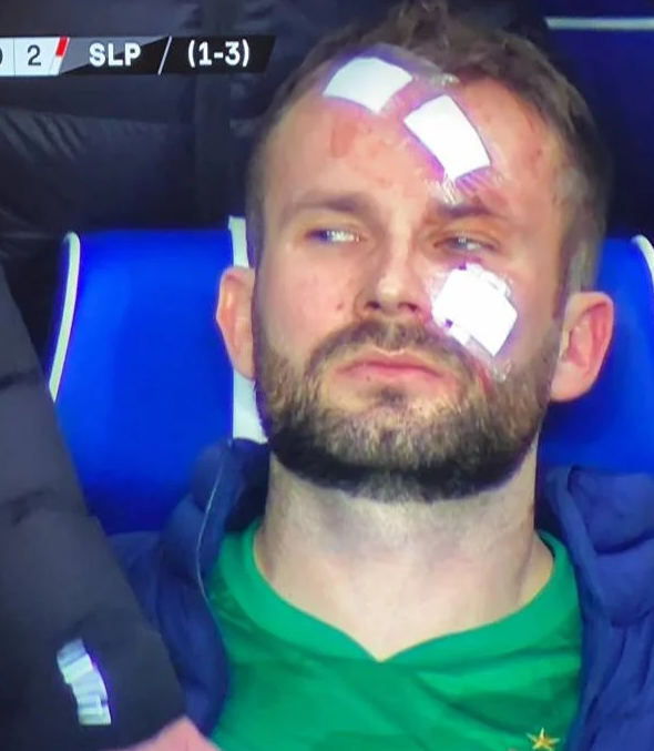 TWARZ bramkarza Slavii po brutalnym ataku piłkarza Rangers